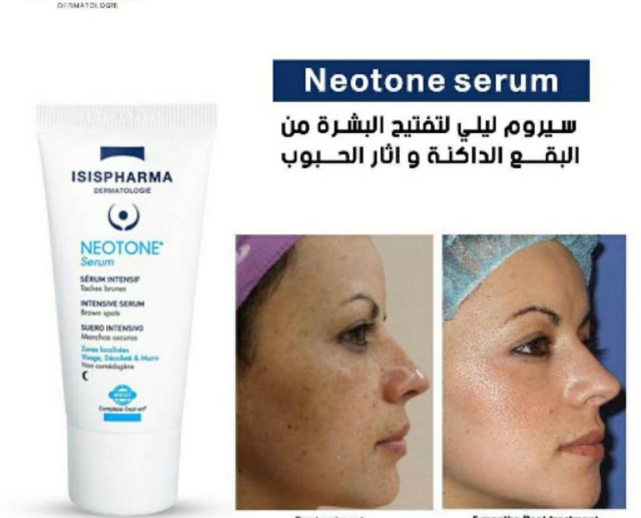 Isispharma neotone intensive serum 30ml