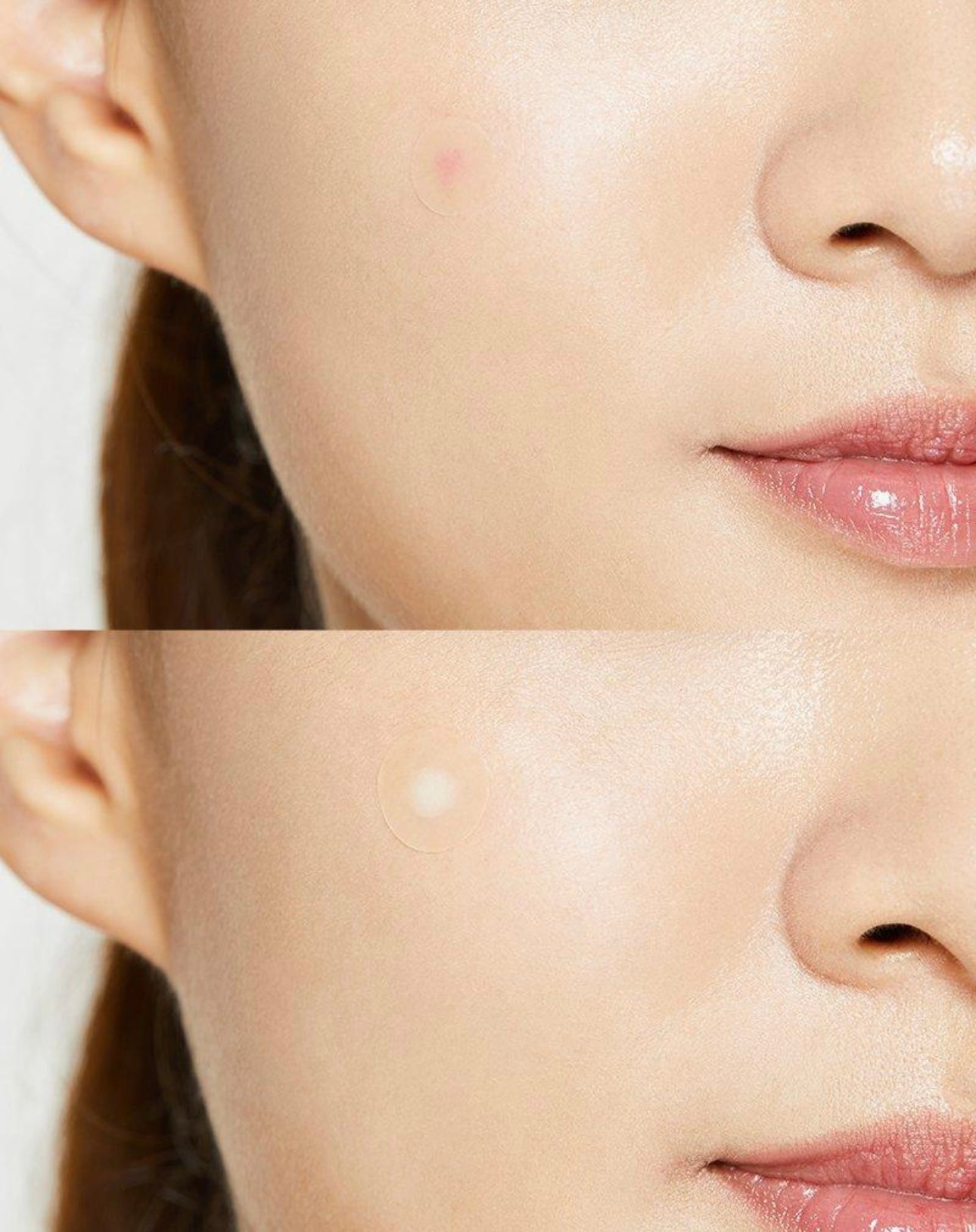 COSRX - Acne Pimple Master Patch