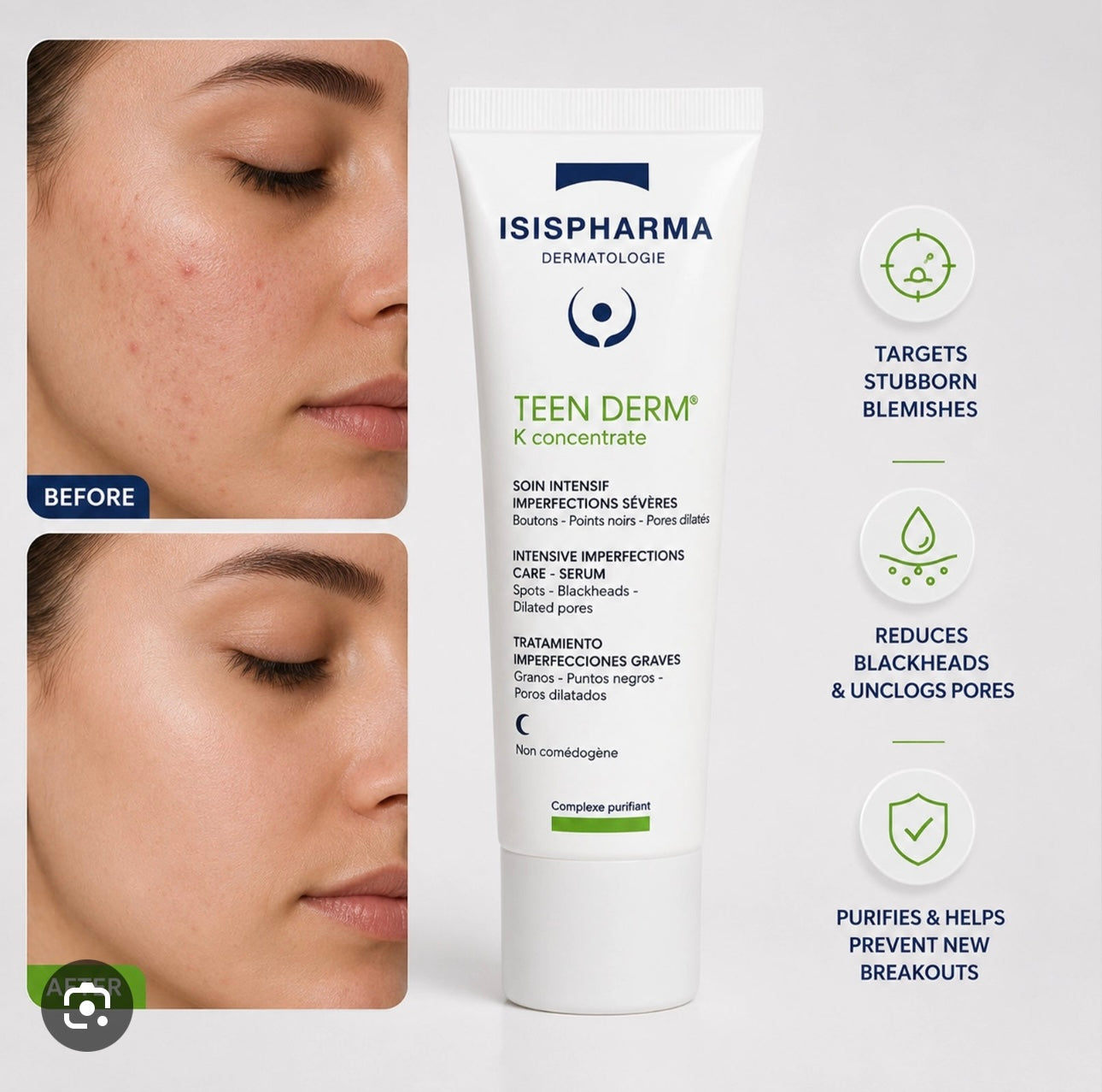 Isispharma teen derm k concentrate gel cream