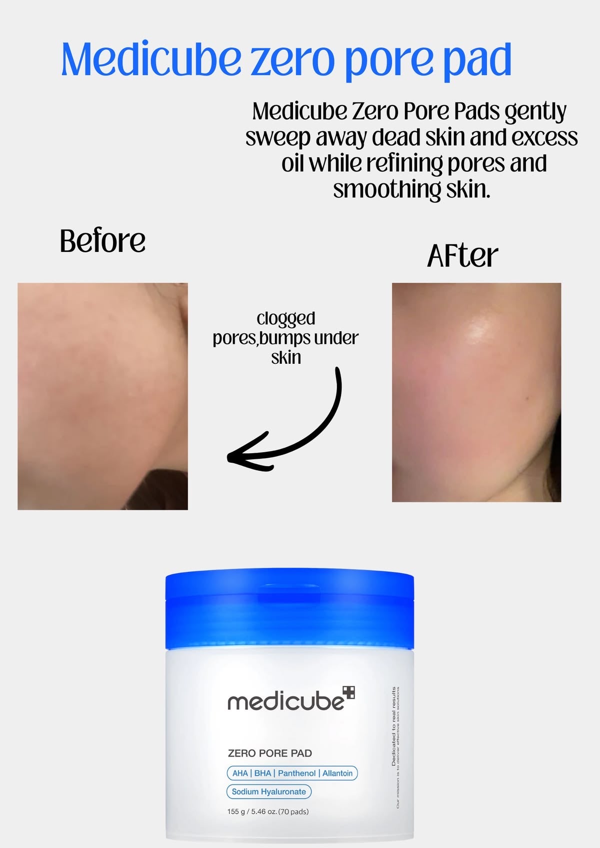 Medicube - Zero Pore Pad 2.0 70pads Secondary image