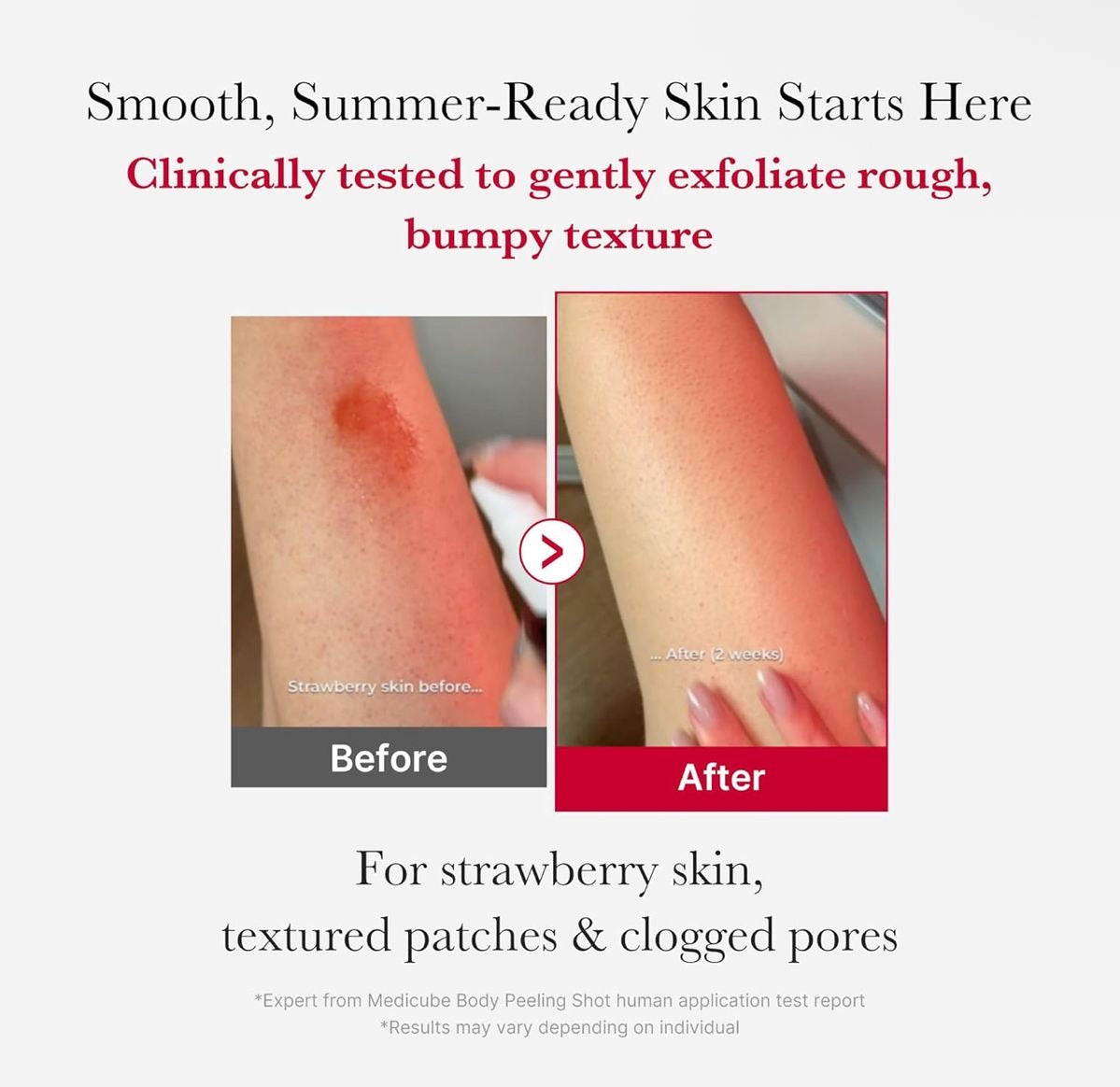 Medicube - Red Acne Body Peeling Shot 110G