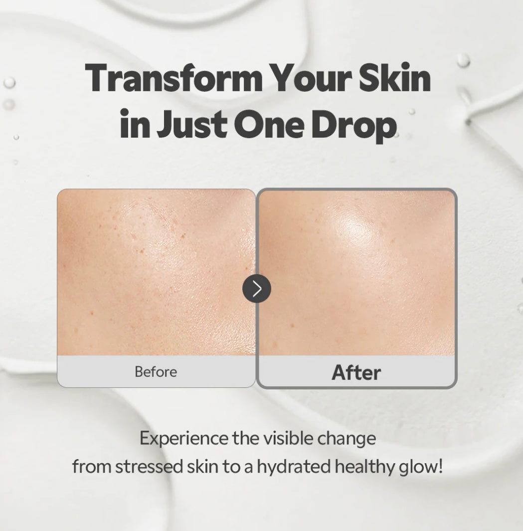 TIRTIR - SOS Serum 50ML