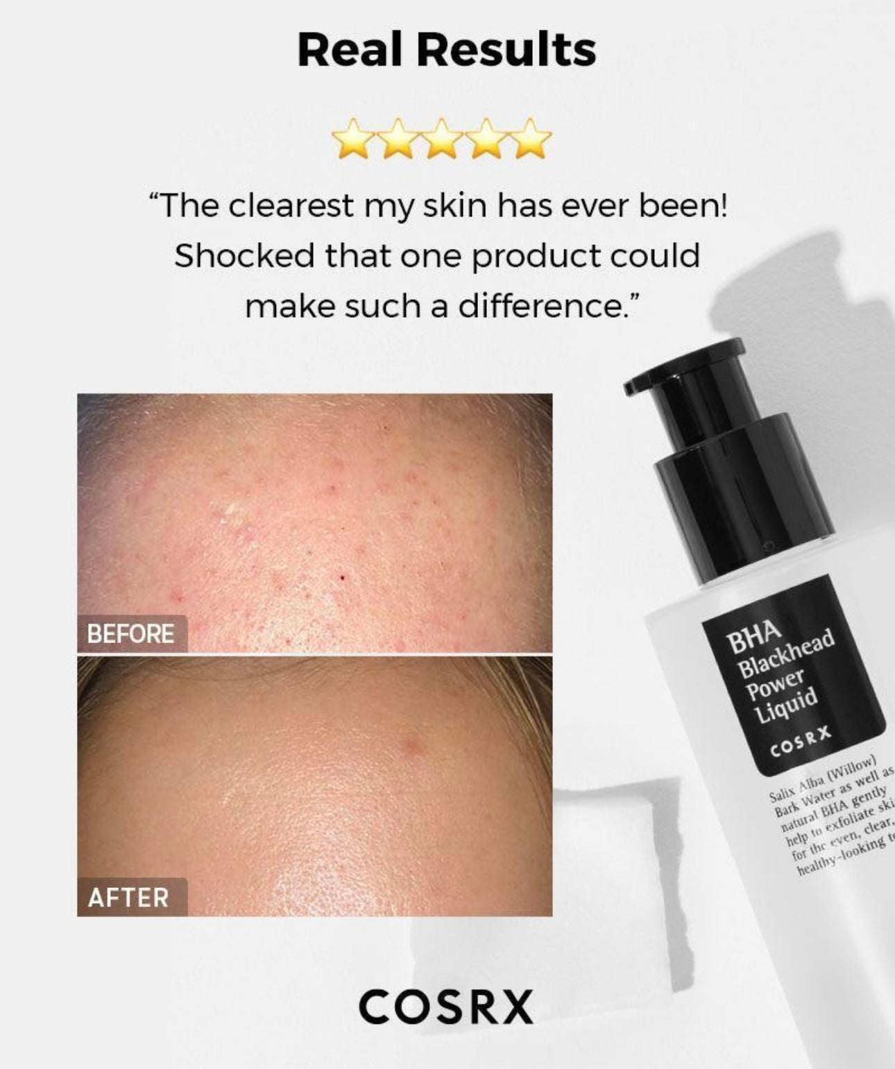 COSRX - BHA BLACKHEAD POWER LIQUID 100 ML
