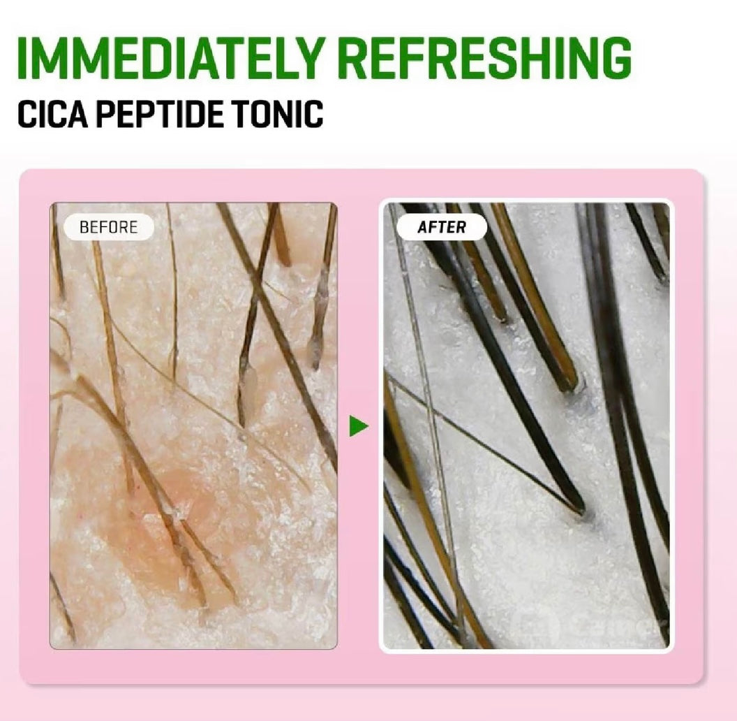 SOME BY MI - Cica Peptide Anti Hair Loss Derma Scalp TONIC 150ml