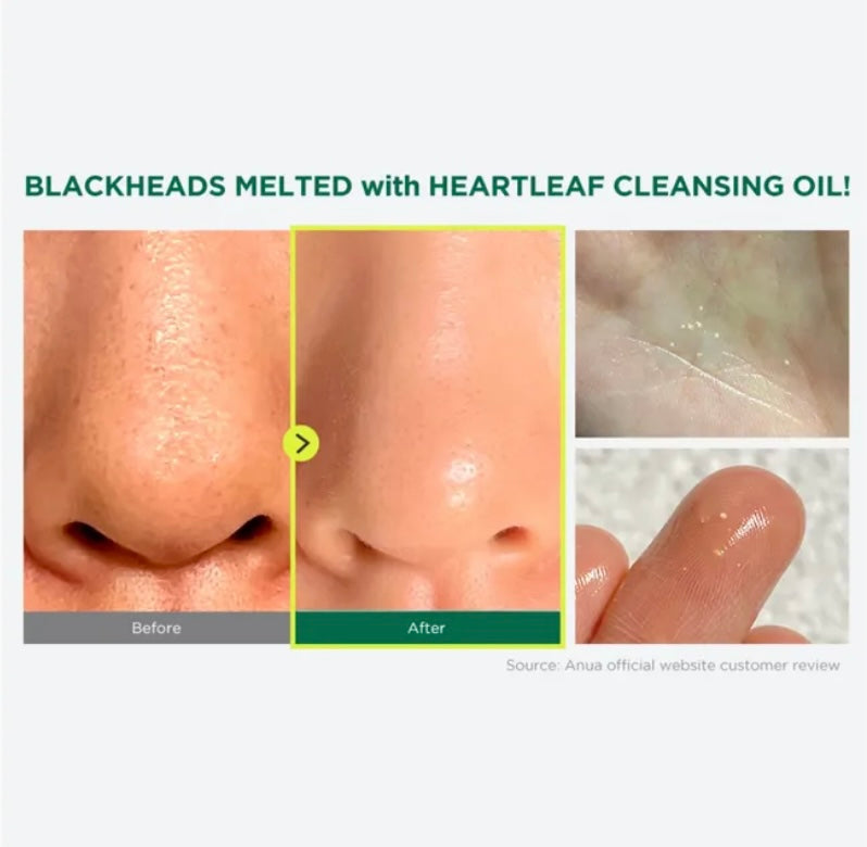 Anua - Heartleaf Pore Control Cleansing Oil 20ml