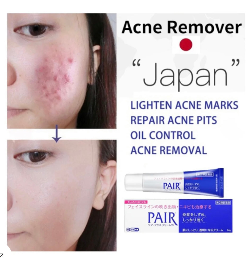 LION - Pair Acne Cream W24G