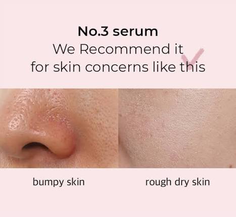 No.3 Skin Softening Serum