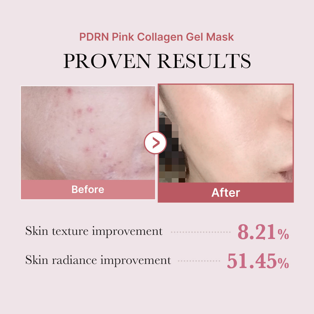 Medicube - PDRN Pink Collagen Gel Mask 4pcs